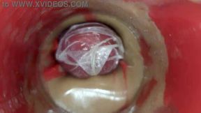 The camera inside the deep pussy records a huge ejaculation with a stuck condom