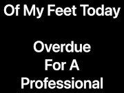Slideshow of His Hard Working, Rough Feet (2021-09-21) In Desperate Need Of A Professional Pedicure