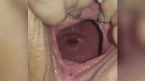 Plump vagina&#x1F32E;&#xFE0F; and cervical display