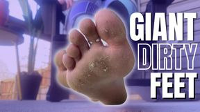 Giant Dirty Feet