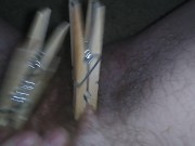 Genital Clamped Pre Op Trans Man, Clamped Lips