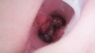 Cervix play