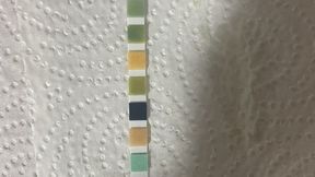 Nurse Gets A Urinalysis