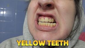Brushing My Filthy Yellow Croocked Teeth Until They Shine – Close-Up Mouth, Dirty Oral Hygiene, Real Tooth Cleaning Fetish