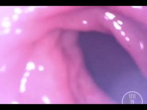 POV Extreme Deep Anal Examination!