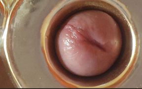Boy Close up Tight Uncircumcised Glans Excited