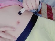 boy tries to enlarge his belly button by cotton swabs!