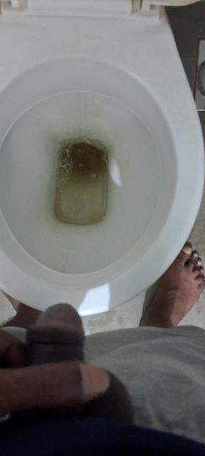 Pissing full of bllader
