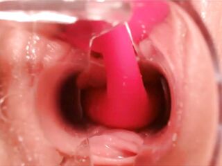 OhMiBod Creamy Cum Speculum Unfathomable Inside Cervix