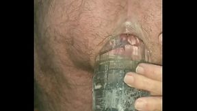 Deep Insertion on Plastic Bottle.