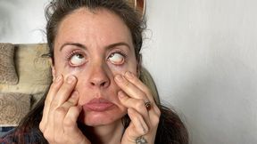 silly faces with eye crossing mo