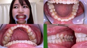 Satomi Mioka - Watching Inside mouth of Japanese cute girl - MOV
