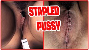 Sadistic doctor closes and staples his patient&#039;s pussy
