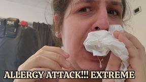 Allergy day: lot of snot, mucus and sneeze ( i cant stop)