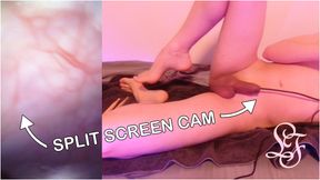 How Fisting Looks inside the Bladder - INSANE SPLIT SCREEN