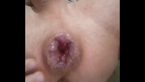 I jerk off my hemorrhoidal rose