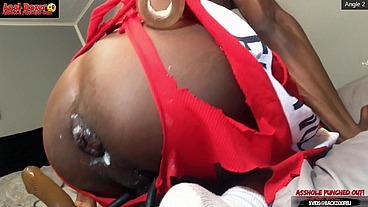 Asshole Punched Out - Ass Monkey XL Inflatable Buttplug Angle 2 Part 1
