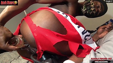 Asshole Punched Out - Ass Monkey XL Inflatable Buttplug Angle 2 Part 1