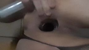 Anal dilation step by step