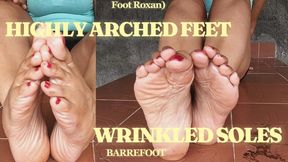Delicious wrinkled soles combined with pronounced arches (3)