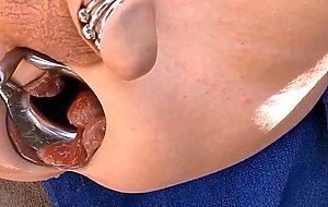 Extreme Anal Fisting for My Loose Sloppy Asshole