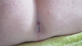 Hole closeup