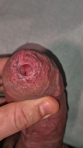 Close up on Phimosis Large Cock, so Hot!