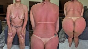 acabei de chegar do bronze e olha como estao as minhas marquinhas.. gostam de ver assim, tudo marcadinho?