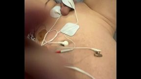 Fignutz overdoes the electroshock: compares import to US device