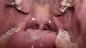Exploring My Mouth Uvula Close-Up copy