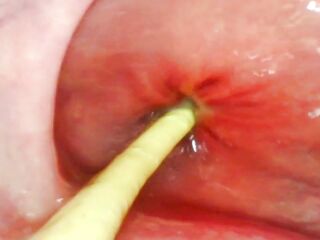 EXTRAORDINARY ANAL POV. CAMERA INSIDE HER ARSEHOLE AS I POUND HER WITH MY LARGE DICK AND CUM UNFATHOMABLE INSIDE