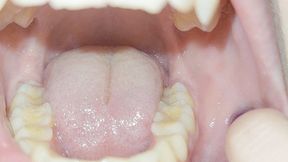 teeth tour -admire my sexy teeth