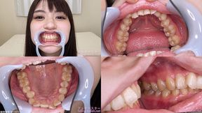 Satori - Watching Inside mouth of Japanese cute girl bite-172-1 - wmv 1080p