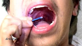 touching the uvula with swabs