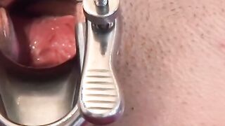 Lady gets her pussy spread and creampied by the doctor