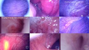 COMPILATION: Endoscope in my Dick, Ass and Bladder