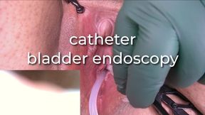 catheter bladder endoscopy