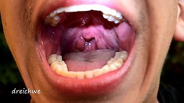 Early morning uvula