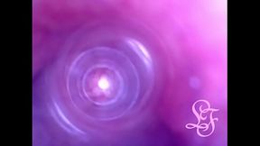 Endoscope Journey into My Deepest Intestines