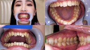 An Komatsu - Watching Inside mouth of Japanese beautiful lady - 1080p