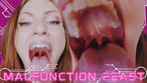 Malfunction Feast! Ft Riot Starter - HD MP4 1080p