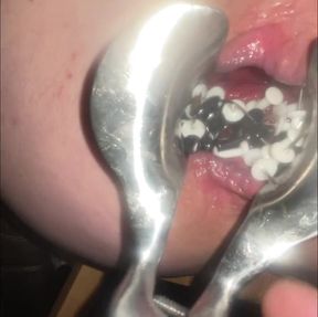 Nipple and anal torment with thumbtacks