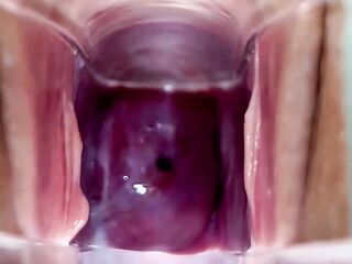 Cervix Closeup Using Speculum - Watch Inside Her Cunt