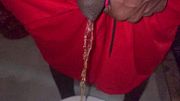 Holding Pee But Bladder Bulge in Toilet - 004