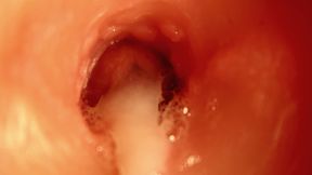 Huge Cumshot inside HOLE! BEST CUMSHOT INSIDE ANAL! ASMR