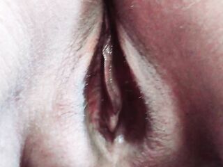 Moisturising my bottom