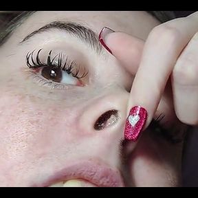 My Nose with Snot up Close