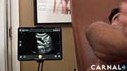 Doctor uses anal ultrasound during sex