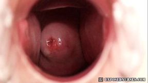 Nurse Zaneta speculum masturbation at clinic