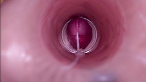 female insemination - internal camera captures deep male ejaculation